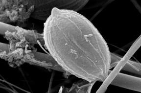 Imagen Investigadores de la Universidad de Oviedo hallan una nueva especie de microalga en charcas de lluvia de un vertedero de residuos en Asturias