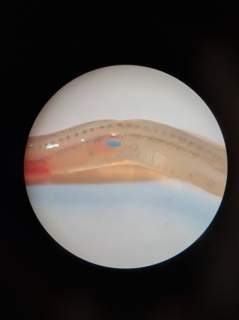angula al microscopio